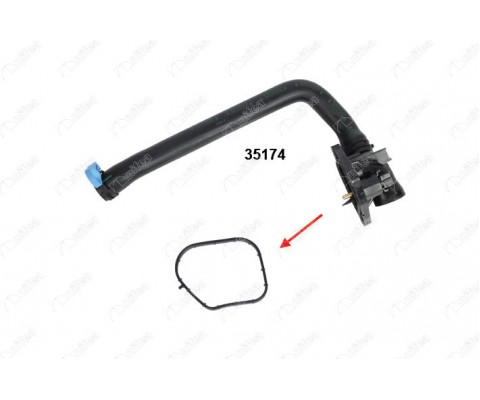 TERMOSTAT HORTUMU CONTASI BMW N13 F20 F21 F30 F31 F35